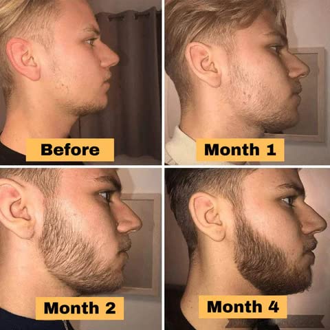 MKKENLEY Beard Growth Oil for Thicker Facial Hair