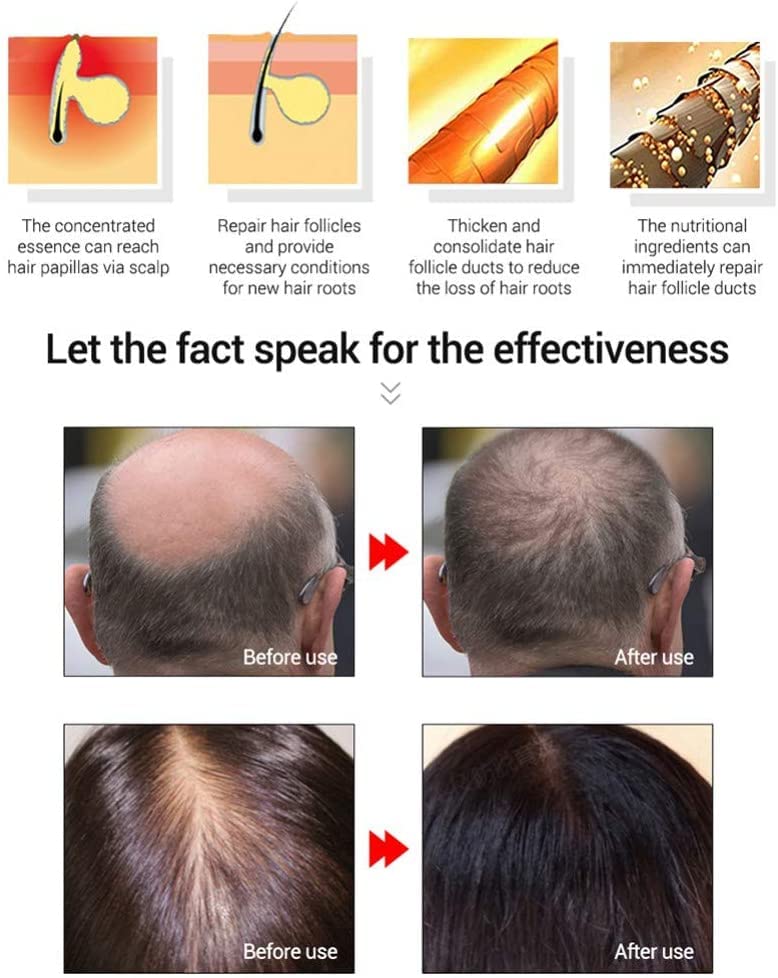 MKKENLEY Natural Ginseng Hair Growth Tonic
