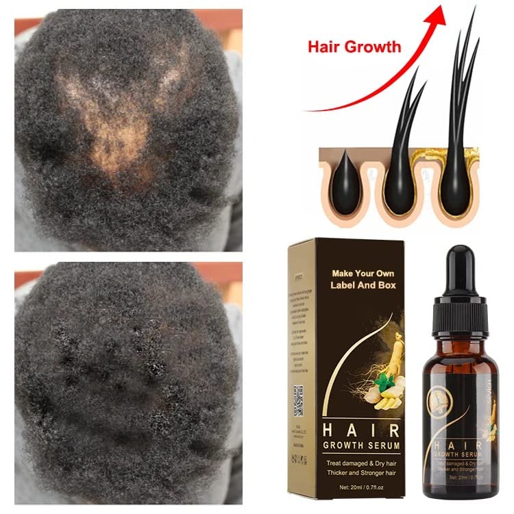 BEST Hair Growth Serum vitamins serum for Hair Loss and Hair Regrowth