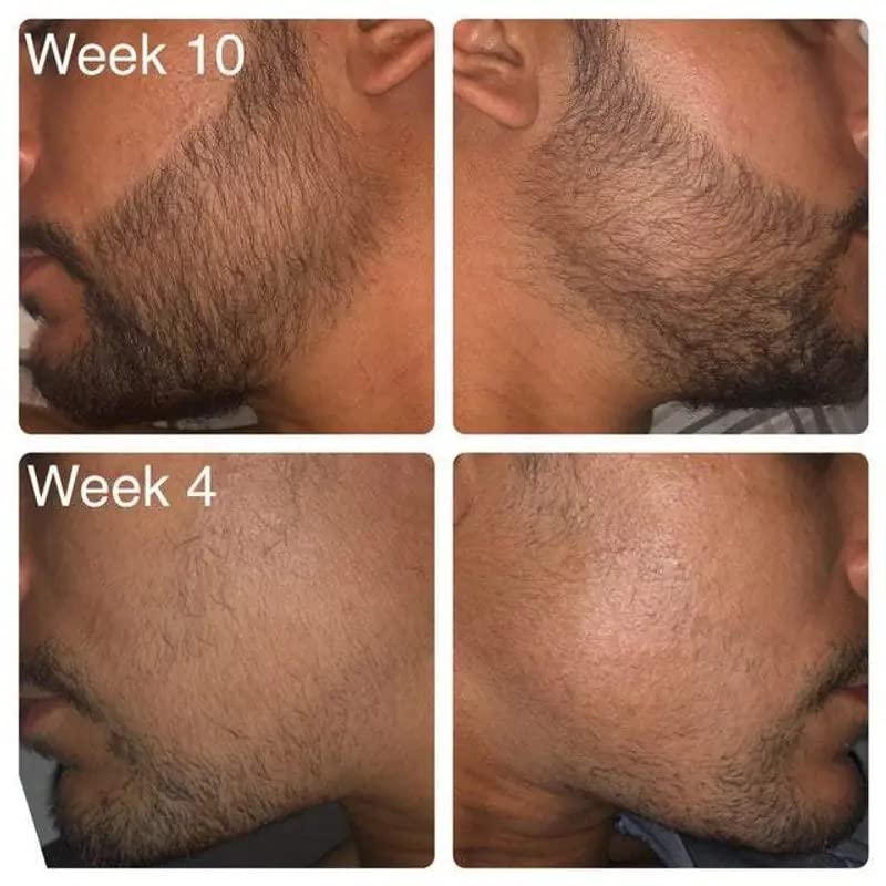 MKKENLEY Beard Growth Oil for Thicker Facial Hair