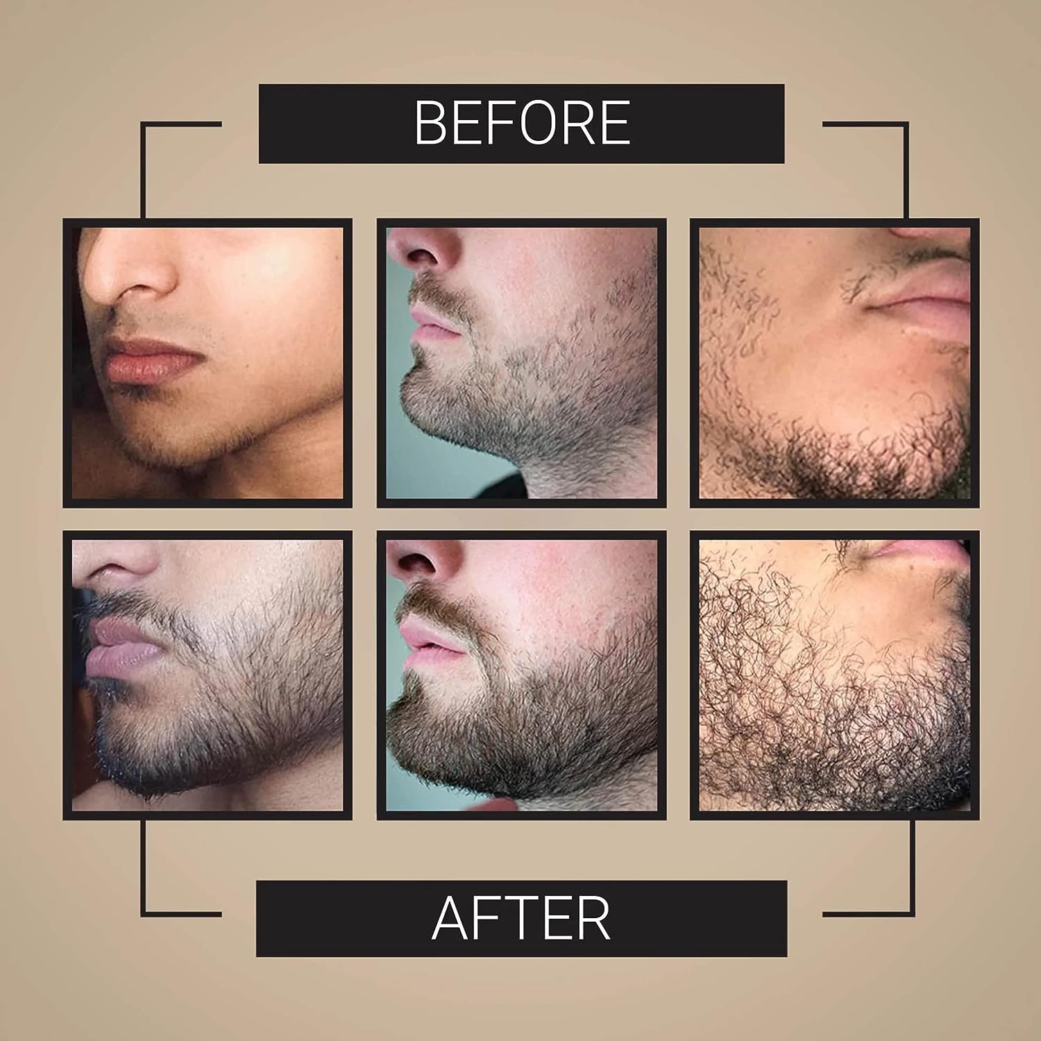 MKKENLEY Beard Growth Oil for Thicker Facial Hair
