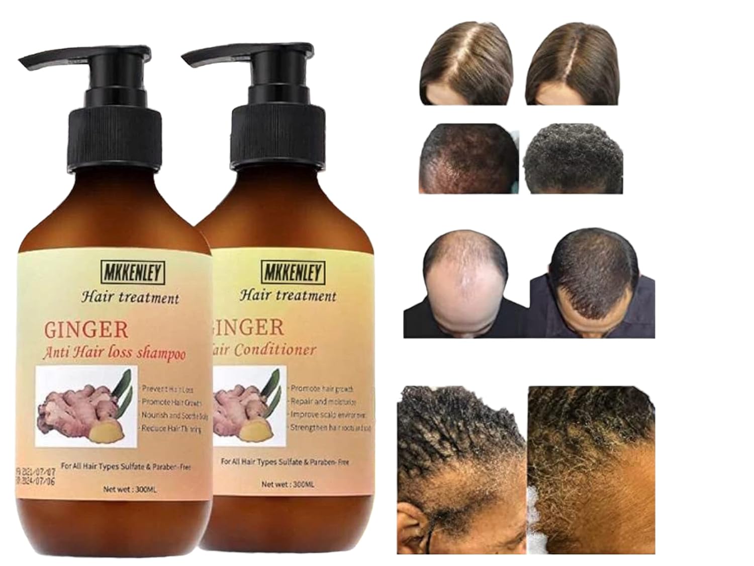 MKKENLEY Anti Hair Loss Ginger Shampoo & Conditioner Set