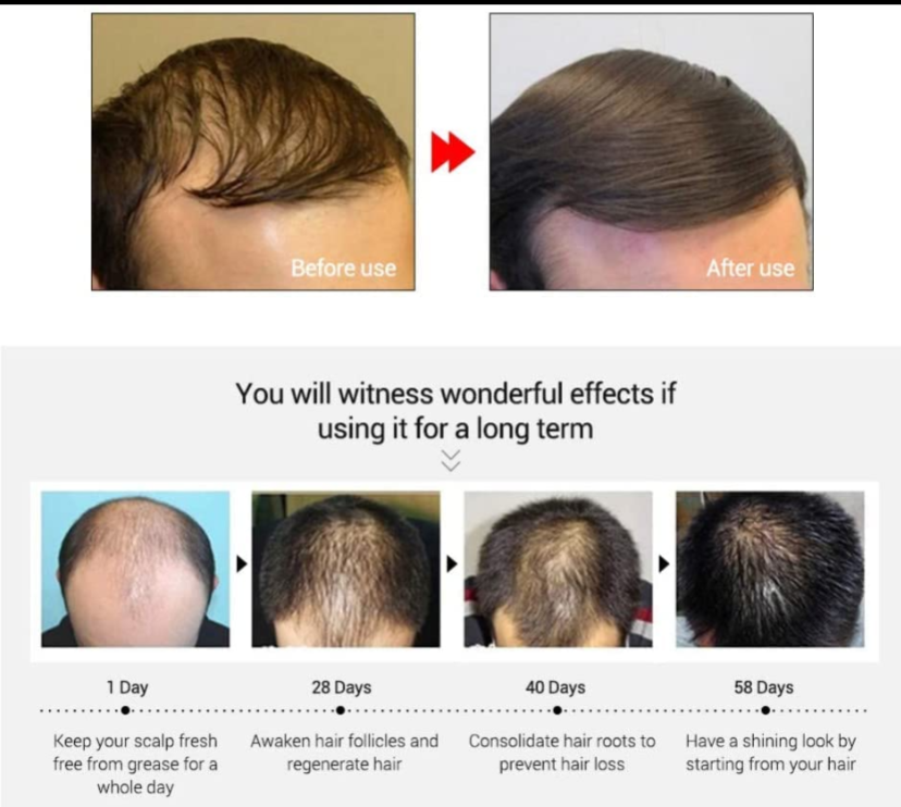 Hair Growth Shampoo, Conditioner, Serum Set