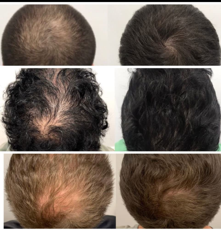 Hair Growth Shampoo, Conditioner, Serum Set